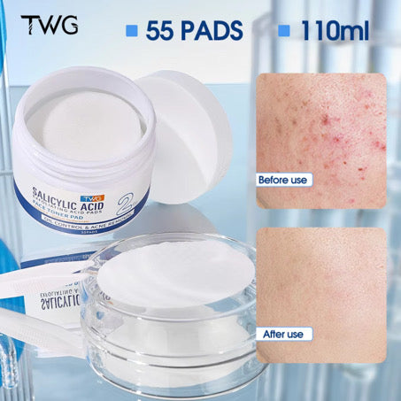 Acne Control Pads